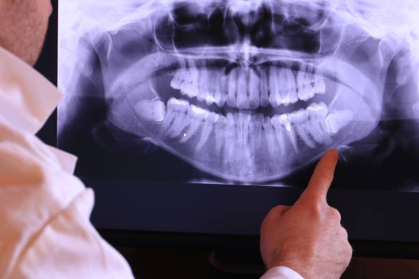 Best Orthodontic Emergency Dentist in Atkins, VA