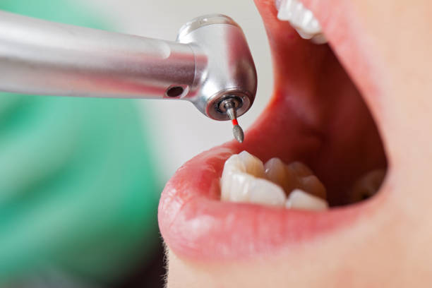 Best Emergency Dentist for Special Needs Patients in Atkins, VA